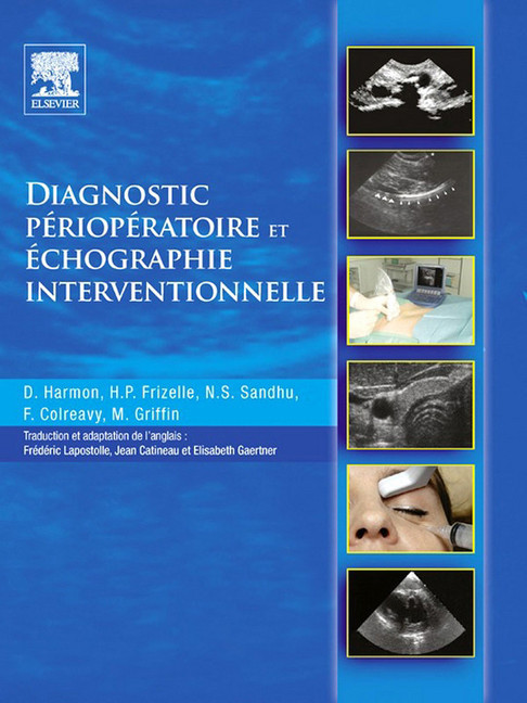 Diagnostic périopératoire et échographie interventionnelle main product photo
