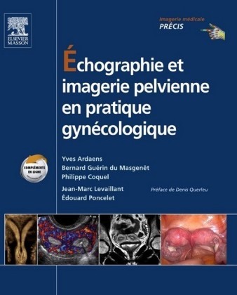 Échographie et imagerie pelvienne en pratique gynécologique