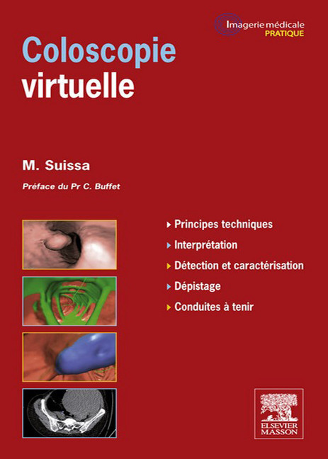 Coloscopie virtuelle main product photo