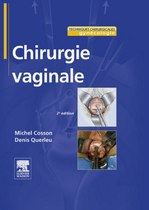 Chirurgie vaginale