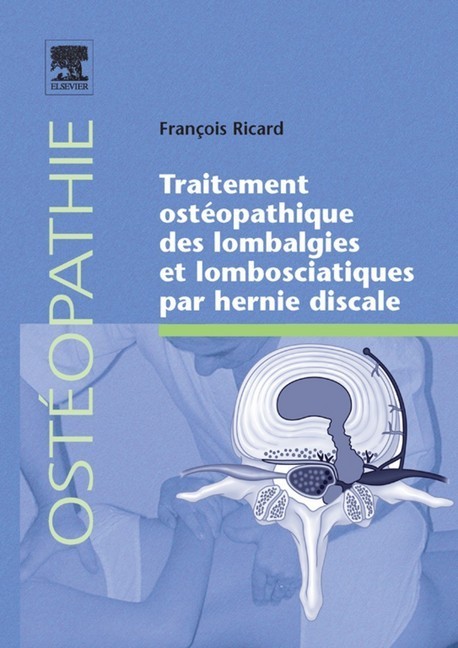 Traitement ostéopathique des lombalgies et lombosciatiques par hernie discale main product photo