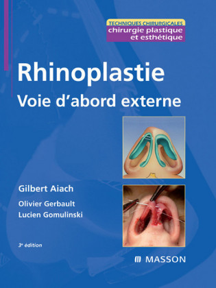 Rhinoplastie. Voie d'abord externe