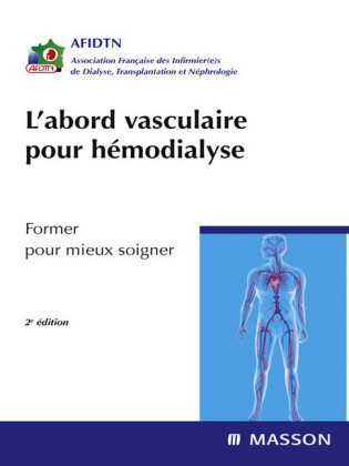 L'abord vasculaire pour hémodialyse
