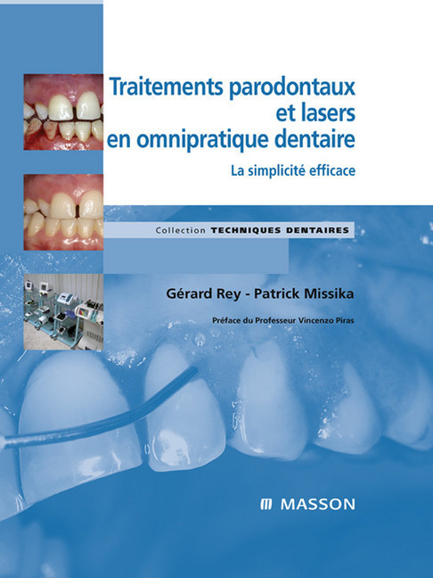 Traitements parodontaux et lasers en omnipratique dentaire main product photo