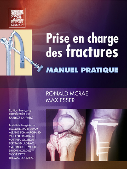 Prise en charge des fractures main product photo