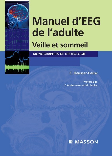 Manuel d'EEG de l'adulte main product photo