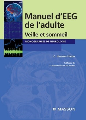Manuel d'EEG de l'adulte