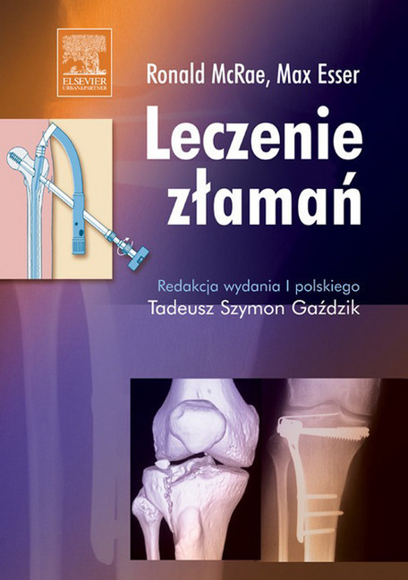 Leczenie zlaman main product photo