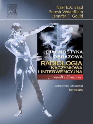 Radiologia naczyniowa i interwencyjna. Seria Diagnostyka Obrazowa Przypadki Kliniczne