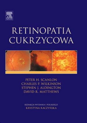 Retinopatia cukrzycowa