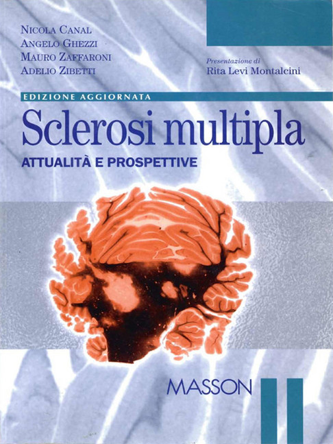 Sclerosi multipla main product photo