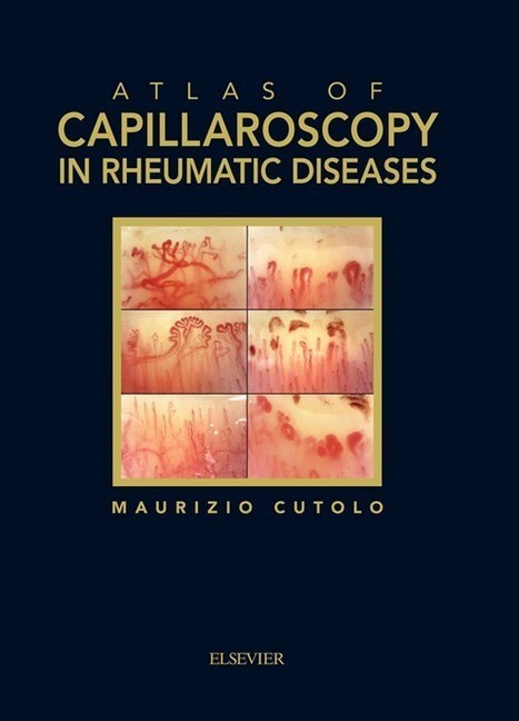 Atlas of capillaroscopy in rheumatic diseases main product photo
