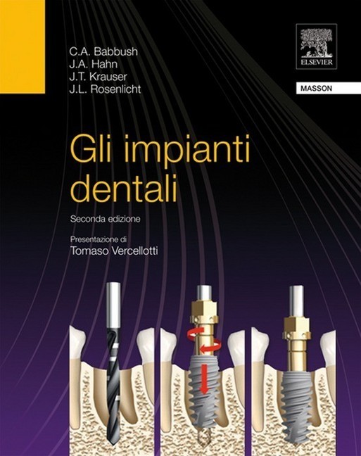 Gli impianti dentali main product photo