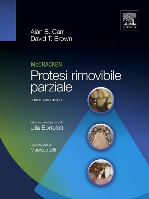 Mc Cracken Protesi rimovibile parziale main product photo