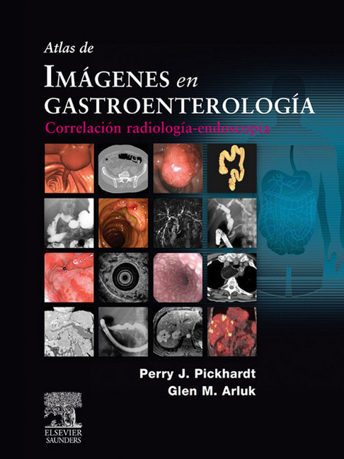 Atlas de imágenes en gastroenterología main product photo
