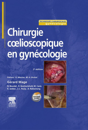 Chirurgie coelioscopique en gynécologie