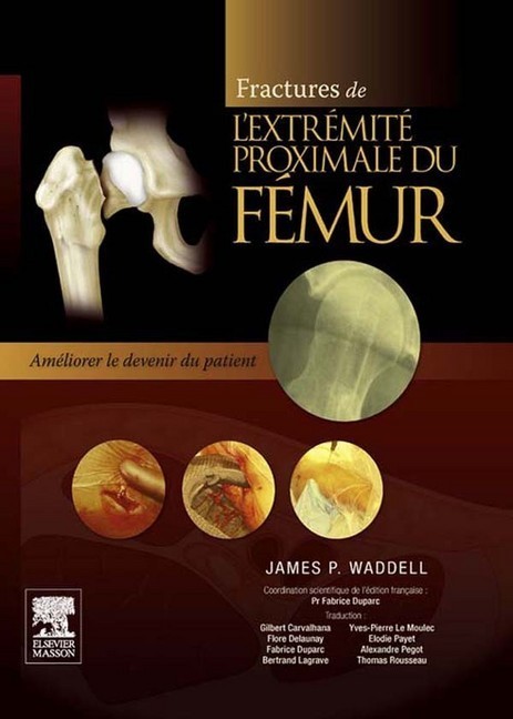 Fractures de l'extrémité proximale du fémur main product photo