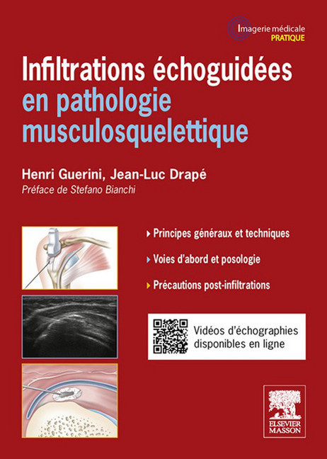 Infiltrations échoguidées main product photo