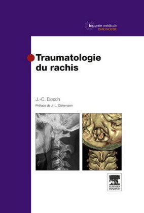 Traumatologie du rachis