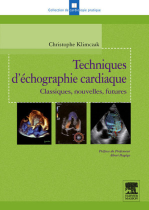 Techniques d'échographie cardiaque