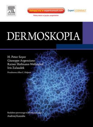 Dermoskopia