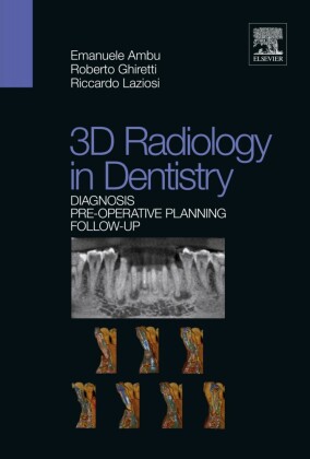 3D radiology in dentistry