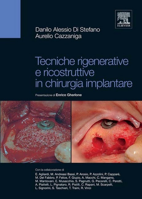 Tecniche rigenerative e ricostruttive in chirurgia implantare main product photo