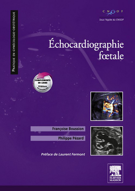 Echocardiographie foetale main product photo