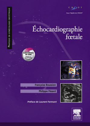 Echocardiographie foetale