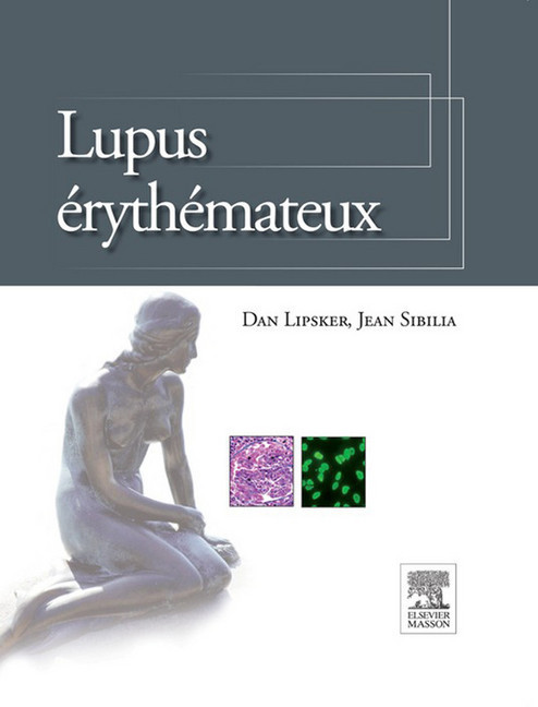 Lupus érythémateux main product photo