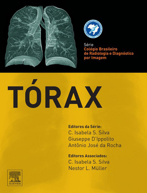 Tórax main product photo