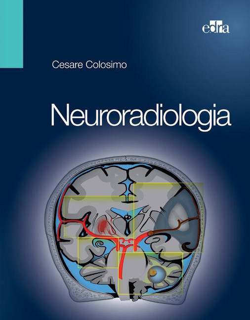 Neuroradiologia main product photo