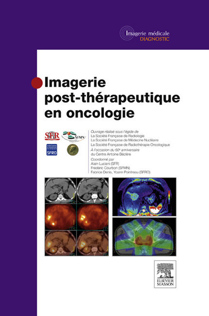 Imagerie post-thérapeutique en oncologie main product photo