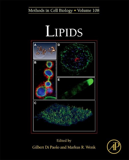 Lipids main product photo