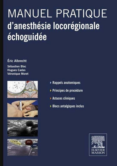Manuel pratique d'anesthésie locorégionale échoguidée main product photo