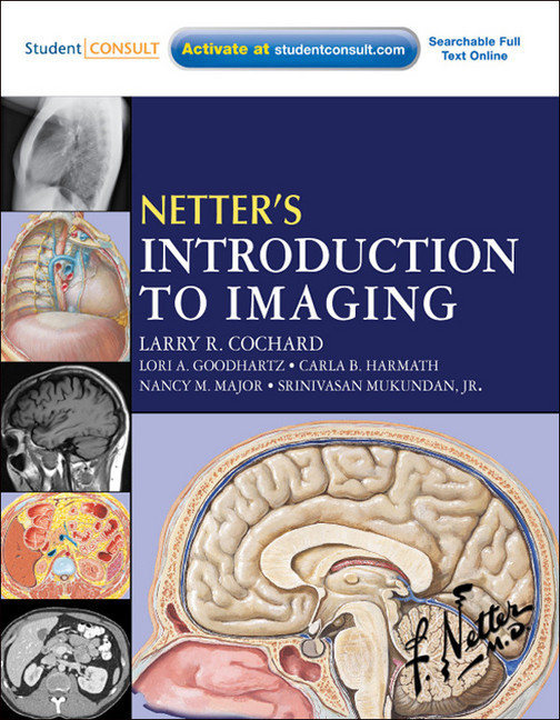 Netter's Introduction to Imaging E-Book main product photo