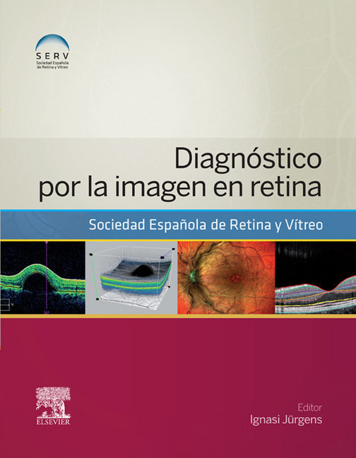 Diagnóstico por la imagen en retina main product photo