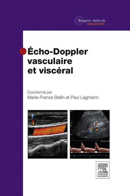 Echo-Doppler vasculaire et viscéral main product photo
