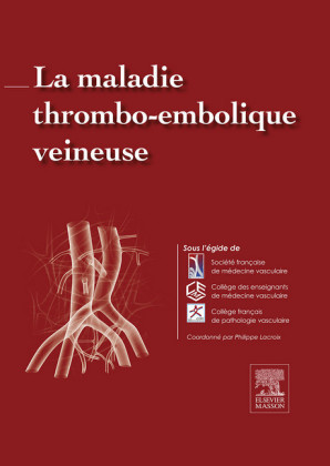 La maladie thromboembolique veineuse