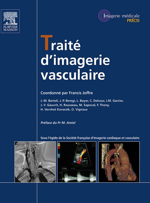 Traité d'imagerie vasculaire main product photo