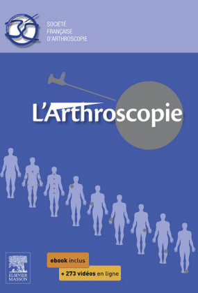 L'arthroscopie