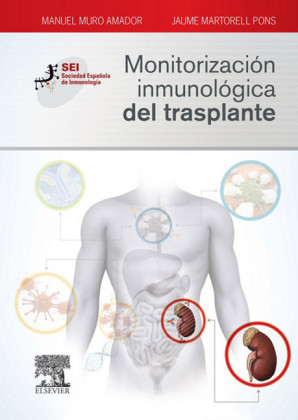 Monitorización inmunológica del trasplante