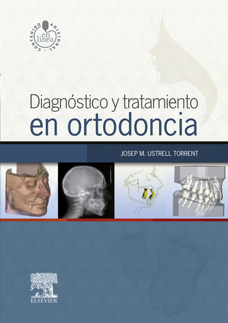 Diagnóstico y tratamiento en ortodoncia + StudentConsult en español main product photo