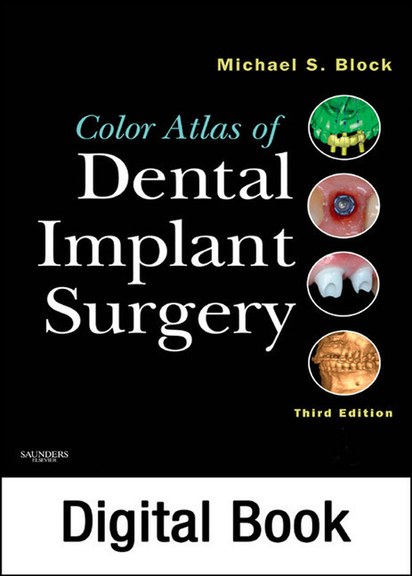 Color Atlas of Dental Implant Surgery - E-Book main product photo