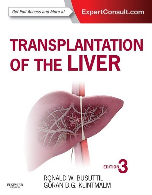 Transplantation of the Liver main product photo