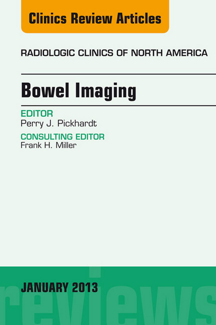 Bowel Imaging, An Issue of Radiologic Clinics of North America main product photo