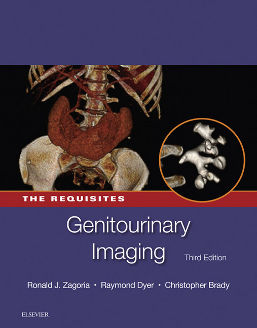Genitourinary Imaging: The Requisites main product photo