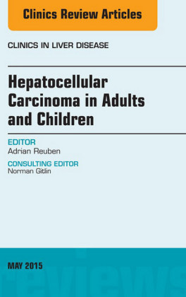 Hepatocellular Carcinoma in Adults and Children, An Issue of Clinics in Liver Disease,