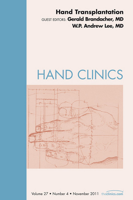 Hand Transplantation, An Issue of Hand Clinics main product photo