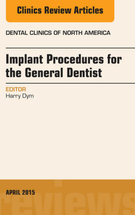 Implant Procedures for the General Dentist, An Issue of Dental Clinics of North America,